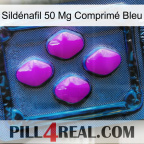 Sildénafil 50 Mg Comprimé Bleu 04